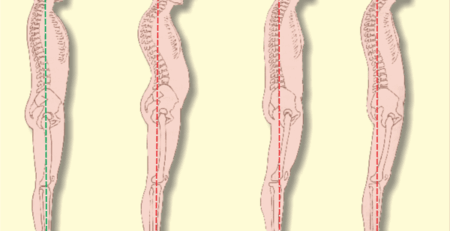 fisioterapia a domicilio coluna